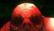 Dementium 2 HD — зачем?!